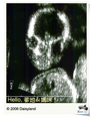 Baby's Face