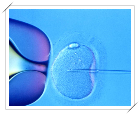 IVF